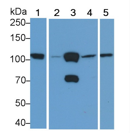 Polyclonal Antibody to Hexokinase 1 (HK1)