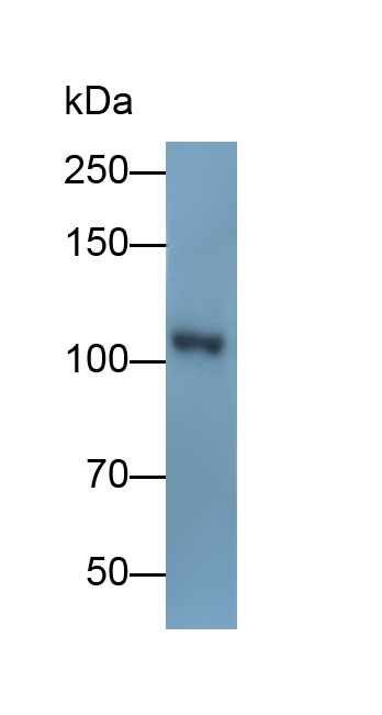 Polyclonal Antibody to Hexokinase 1 (HK1)