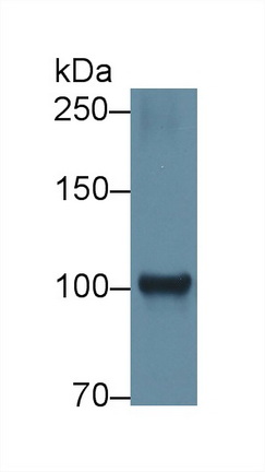 Polyclonal Antibody to Hexokinase 1 (HK1)