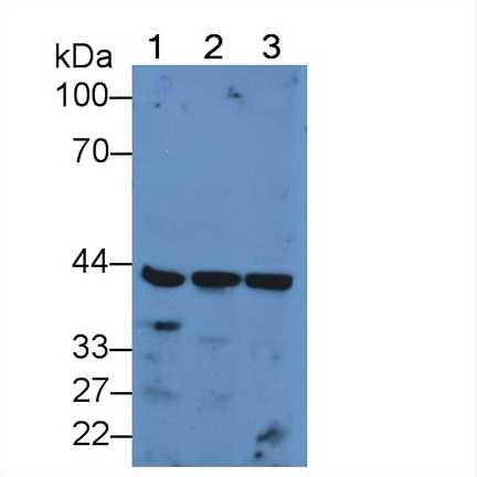 Polyclonal Antibody to Pyruvate dehydrogenase alpha 1 (PDHA1)