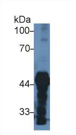 Polyclonal Antibody to Pyruvate dehydrogenase alpha 1 (PDHA1)