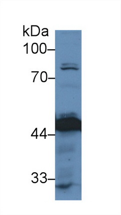 Polyclonal Antibody to Pyruvate dehydrogenase alpha 1 (PDHA1)