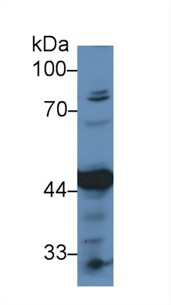 Polyclonal Antibody to Pyruvate dehydrogenase alpha 1 (PDHA1)