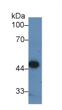 Polyclonal Antibody to Pyruvate dehydrogenase alpha 1 (PDHA1)