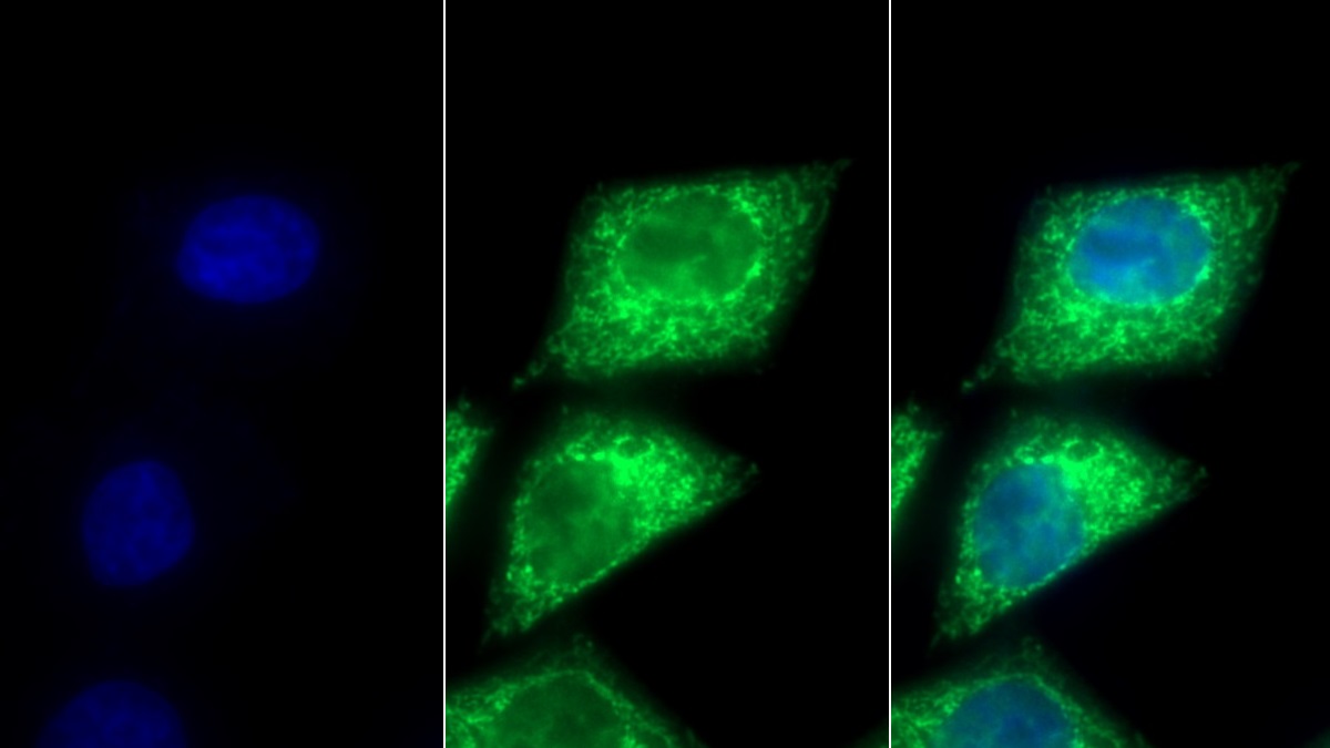 Polyclonal Antibody to Pyruvate dehydrogenase alpha 1 (PDHA1)