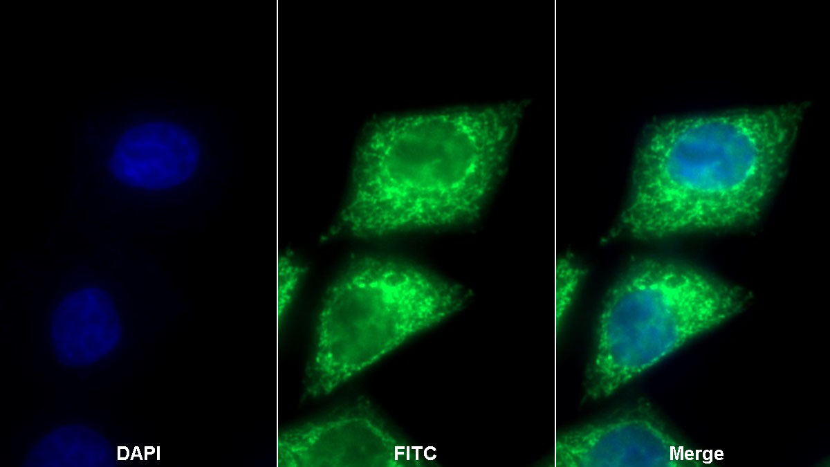 Polyclonal Antibody to Pyruvate dehydrogenase alpha 1 (PDHA1)