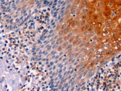 Polyclonal Antibody to B-Cell Leukemia/Lymphoma 2 (Bcl2)