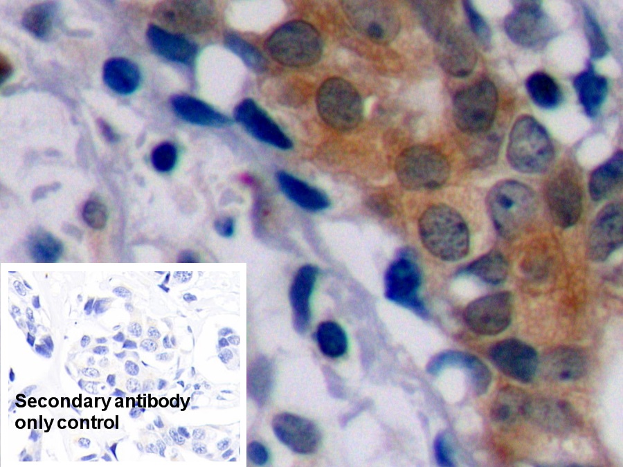 Polyclonal Antibody to B-Cell Leukemia/Lymphoma 2 (Bcl2)