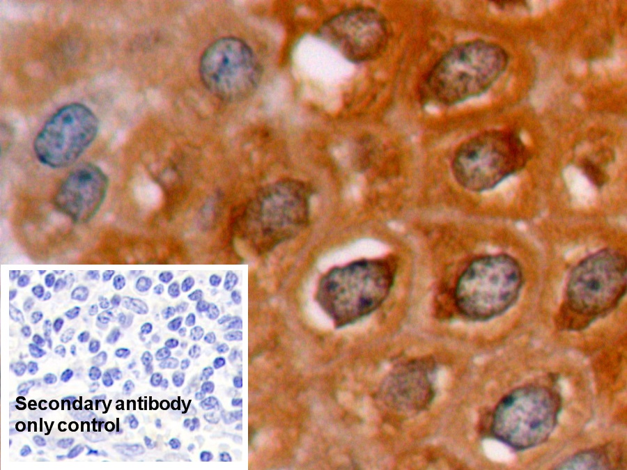 Polyclonal Antibody to B-Cell Leukemia/Lymphoma 2 (Bcl2)