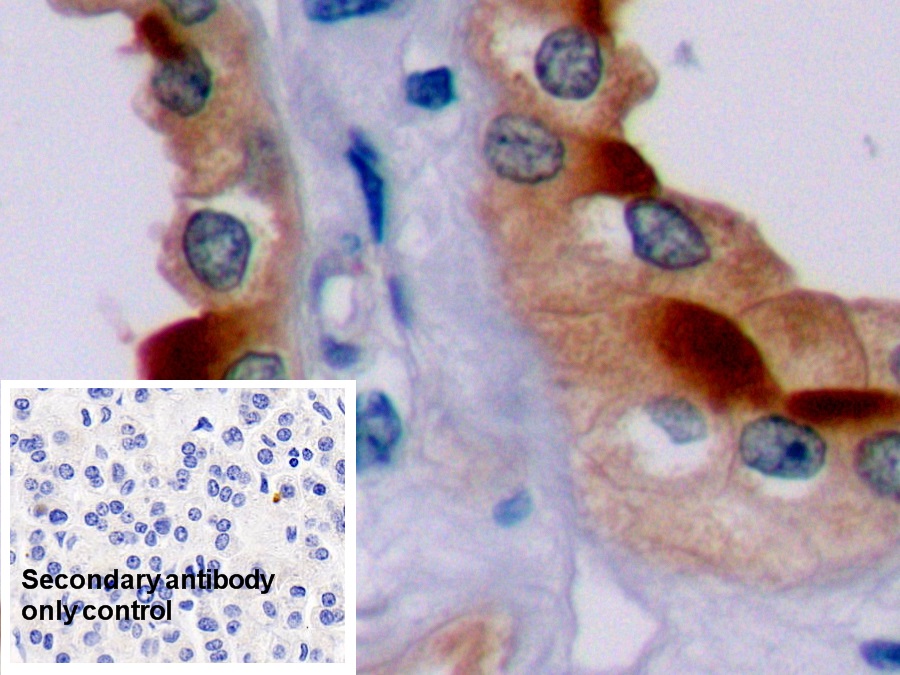 Polyclonal Antibody to B-Cell Leukemia/Lymphoma 2 (Bcl2)