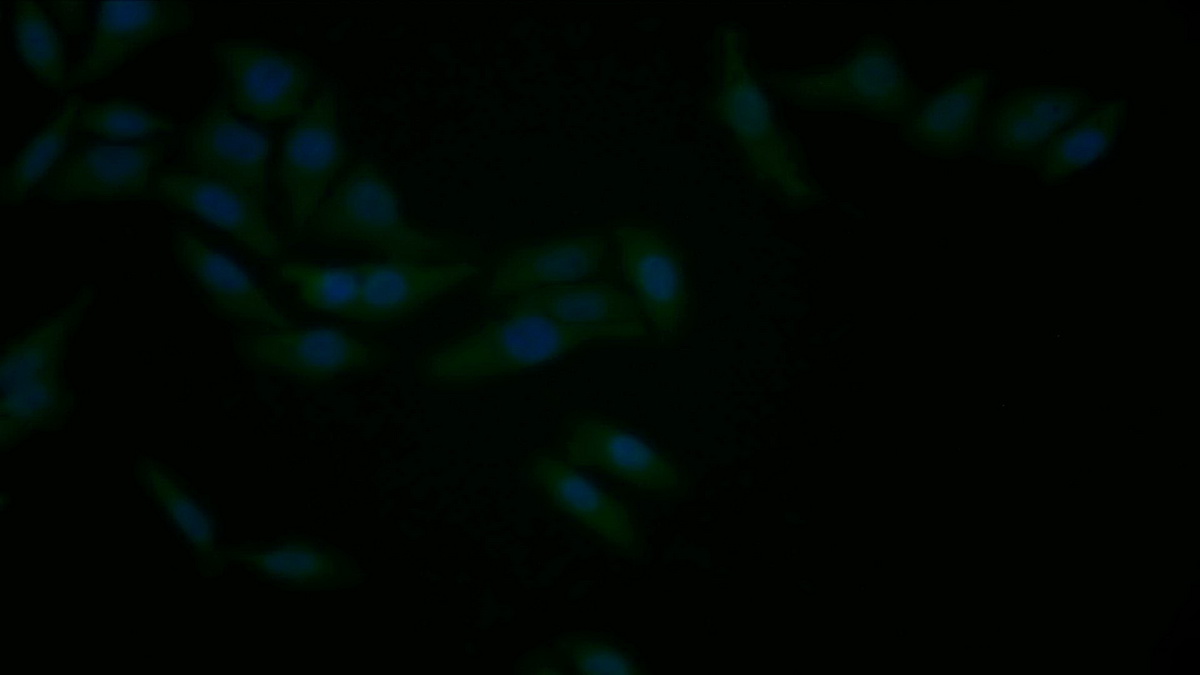 Polyclonal Antibody to B-Cell Leukemia/Lymphoma 2 (Bcl2)