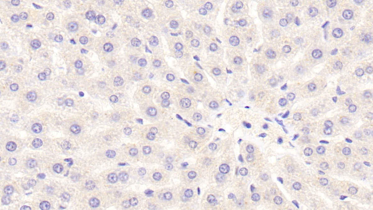 Polyclonal Antibody to Nicotinamide Adenine Dinucleotide Phosphate Oxidase 3 (NOX3)