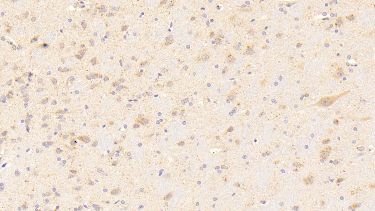 Polyclonal Antibody to Nicotinamide Adenine Dinucleotide Phosphate Oxidase 3 (NOX3)