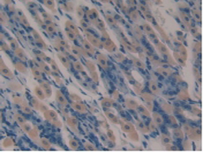 Polyclonal Antibody to Lactoferrin (LTF)