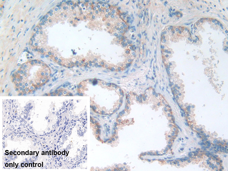 Polyclonal Antibody to Cluster Of Differentiation 276 (CD276)