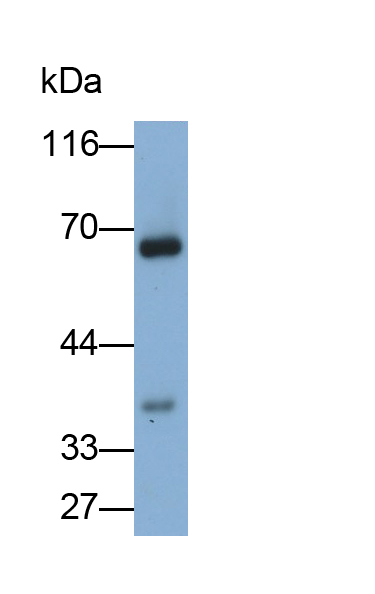 Polyclonal Antibody to Cluster Of Differentiation 276 (CD276)