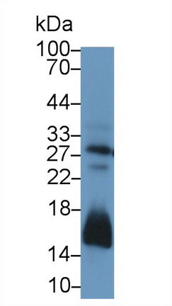 Polyclonal Antibody to Carbonic Anhydrase II (CA2)