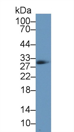 Polyclonal Antibody to Carbonic Anhydrase II (CA2)