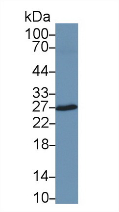 Polyclonal Antibody to Carbonic Anhydrase II (CA2)