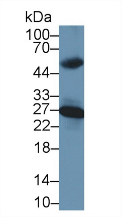 Polyclonal Antibody to Carbonic Anhydrase II (CA2)