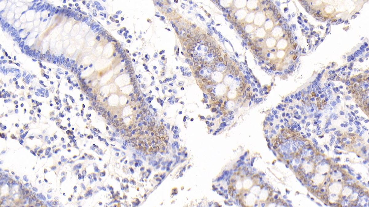 Polyclonal Antibody to Carbonic Anhydrase II (CA2)