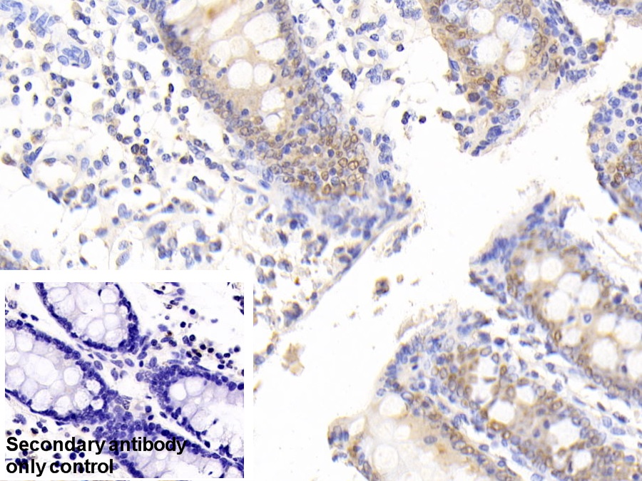 Polyclonal Antibody to Carbonic Anhydrase II (CA2)