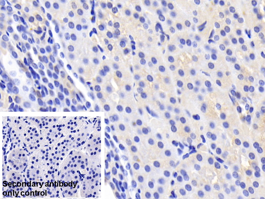 Polyclonal Antibody to Carbonic Anhydrase II (CA2)