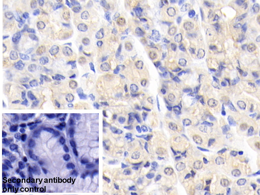 Polyclonal Antibody to Carbonic Anhydrase II (CA2)