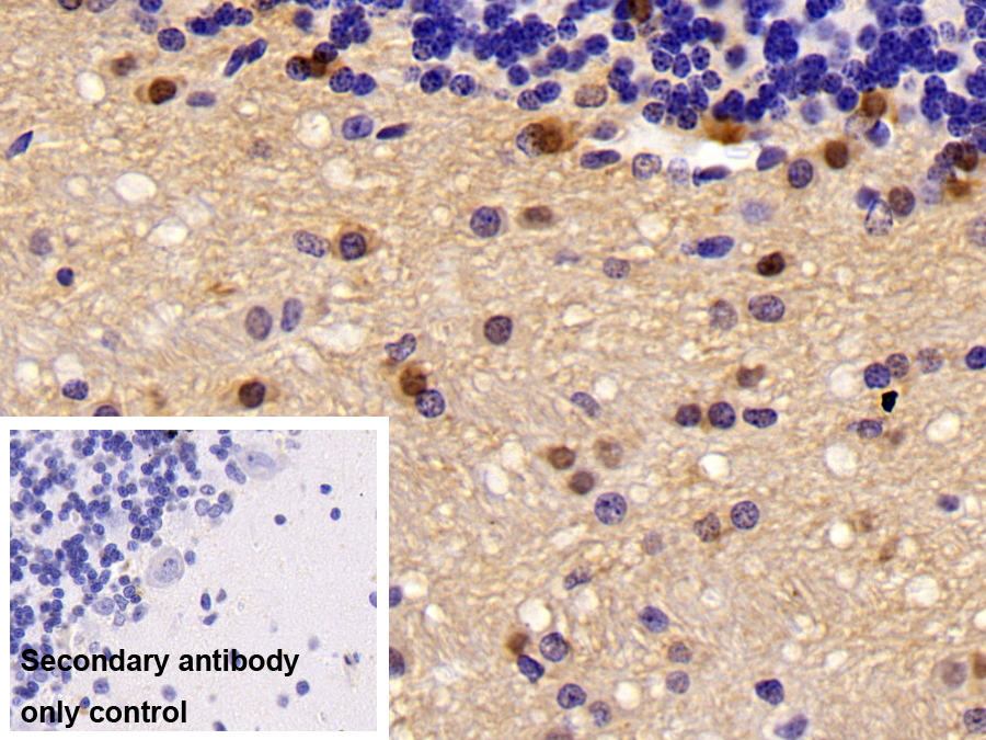 Polyclonal Antibody to Carbonic Anhydrase II (CA2)