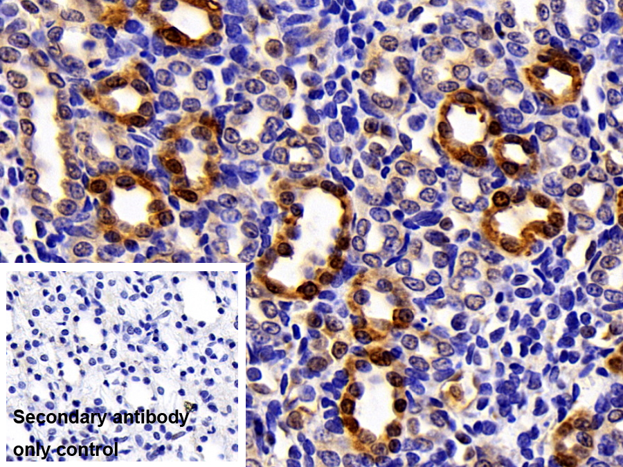 Polyclonal Antibody to Carbonic Anhydrase II (CA2)