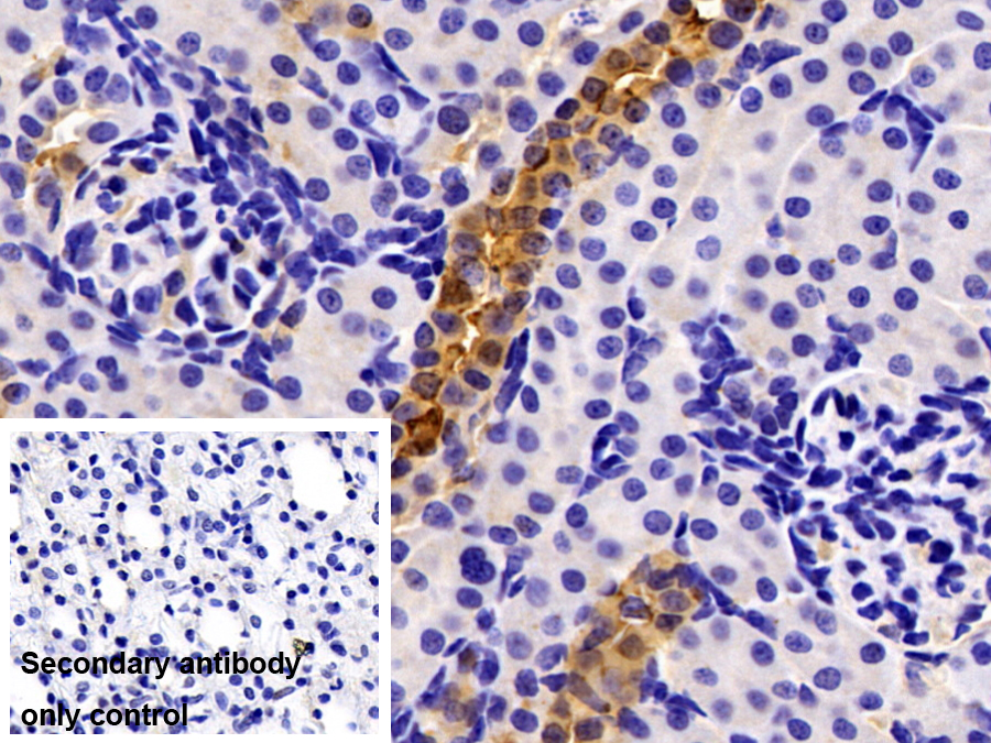 Polyclonal Antibody to Carbonic Anhydrase II (CA2)