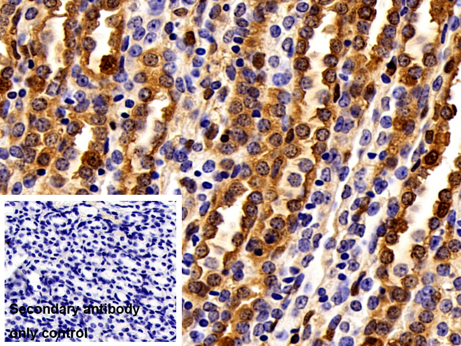 Polyclonal Antibody to Carbonic Anhydrase II (CA2)