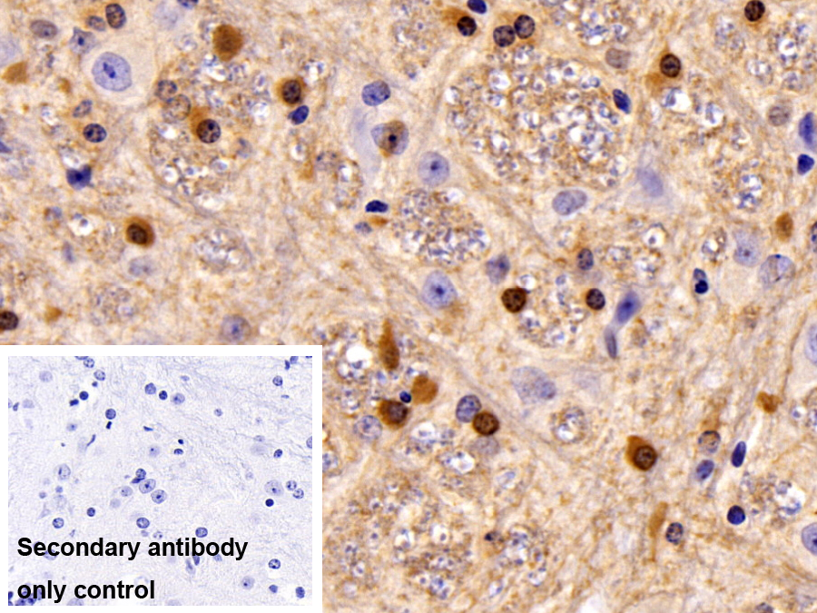 Polyclonal Antibody to Carbonic Anhydrase II (CA2)