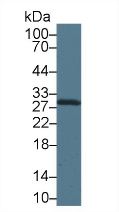 Polyclonal Antibody to Carbonic Anhydrase II (CA2)