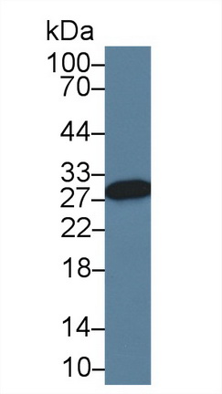 Polyclonal Antibody to Carbonic Anhydrase II (CA2)