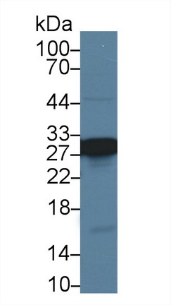 Polyclonal Antibody to Carbonic Anhydrase II (CA2)