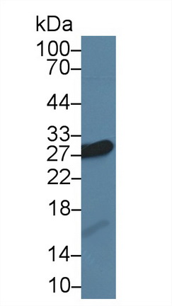 Polyclonal Antibody to Carbonic Anhydrase II (CA2)