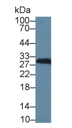 Polyclonal Antibody to Carbonic Anhydrase II (CA2)