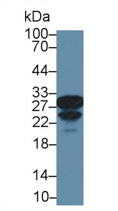 Polyclonal Antibody to Carbonic Anhydrase II (CA2)