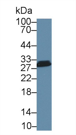 Polyclonal Antibody to Carbonic Anhydrase II (CA2)