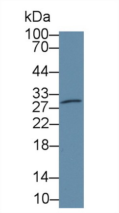 Polyclonal Antibody to Carbonic Anhydrase II (CA2)