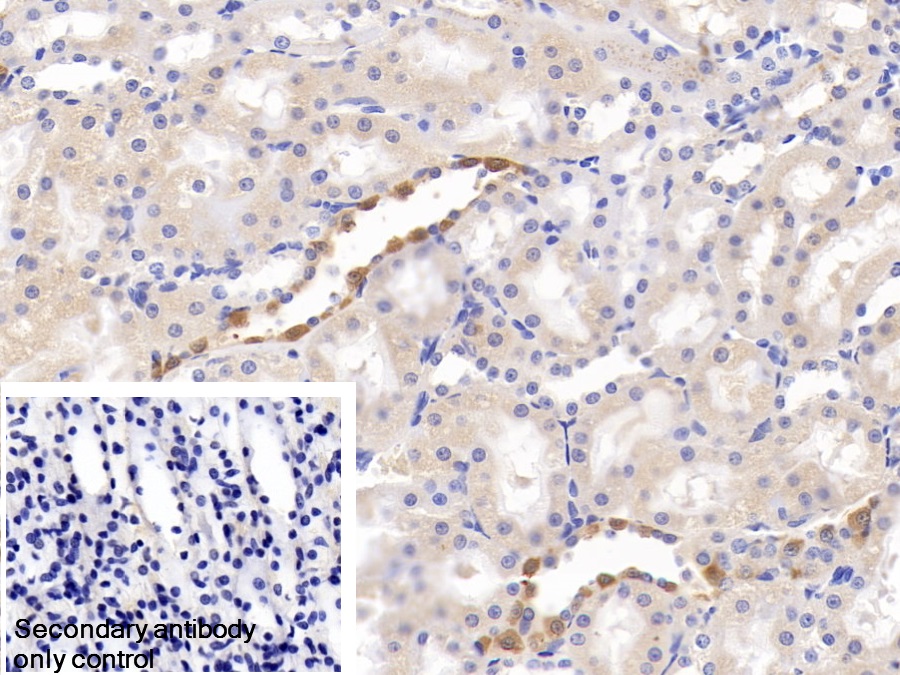 Polyclonal Antibody to Carbonic Anhydrase II (CA2)