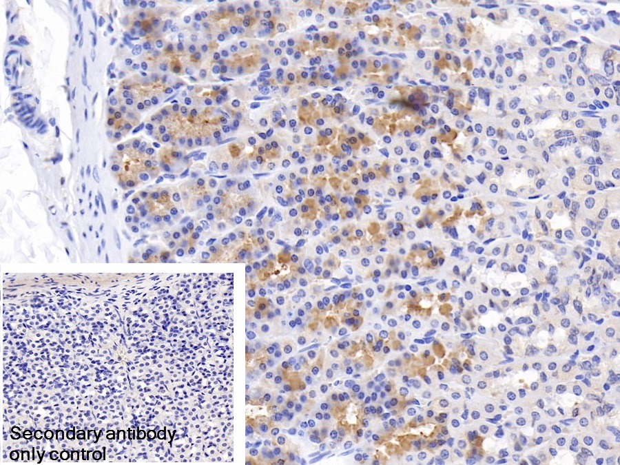 Polyclonal Antibody to Carbonic Anhydrase II (CA2)