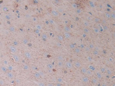 Polyclonal Antibody to Carbonic Anhydrase II (CA2)