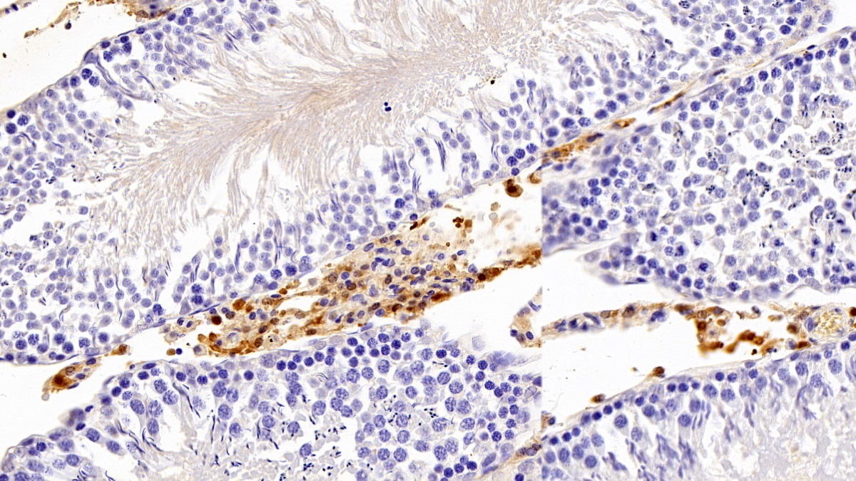 Polyclonal Antibody to Carbonic Anhydrase II (CA2)