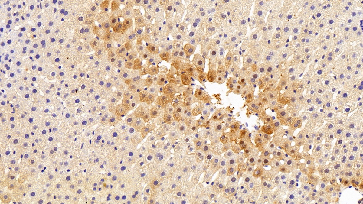 Polyclonal Antibody to Carbonic Anhydrase II (CA2)