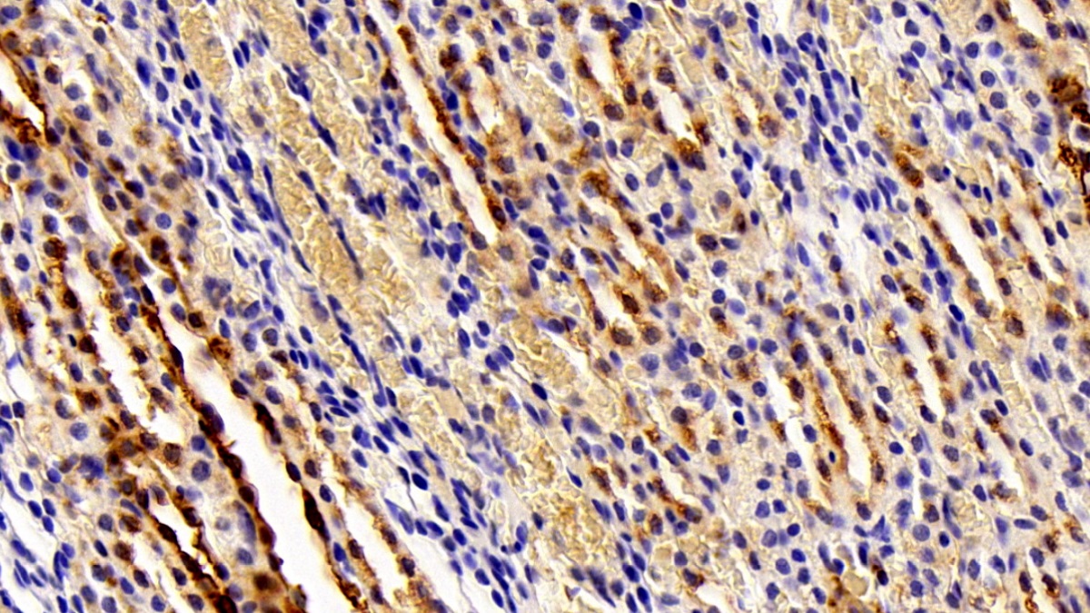 Polyclonal Antibody to Carbonic Anhydrase II (CA2)