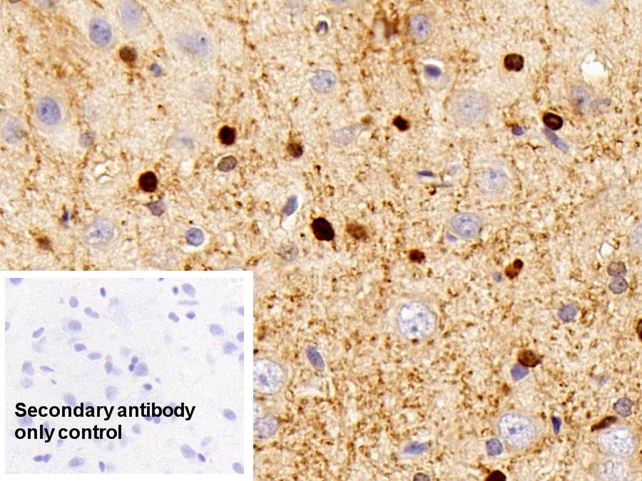 Polyclonal Antibody to Carbonic Anhydrase II (CA2)