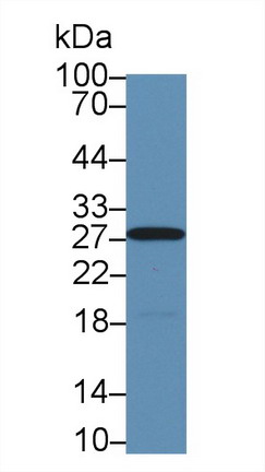 Polyclonal Antibody to Carbonic Anhydrase II (CA2)