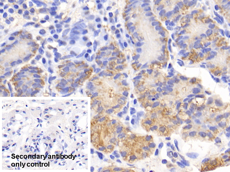 Polyclonal Antibody to Carbonic Anhydrase II (CA2)